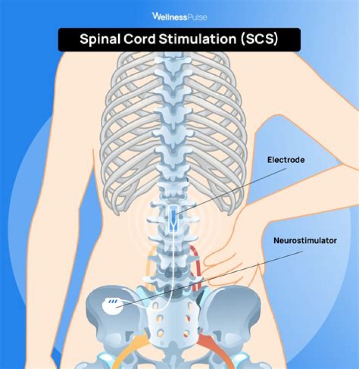 What does a gum stimulator do?